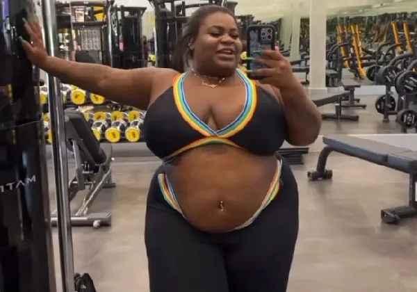 Jojo Todynho passa por cirurgia bariátrica
