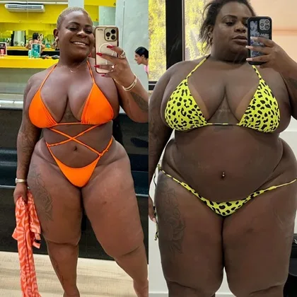 Jojo Todynho exibe antes e depois após perder 53 kg; veja foto