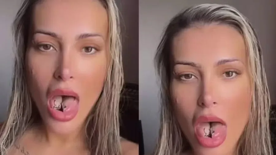 Andressa Urach reclama de dor após procedimento na língua: “Difícil”