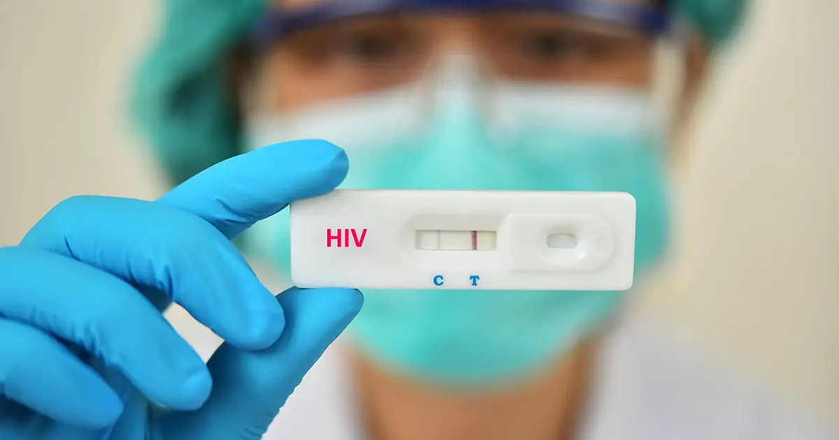 Ministério da Saúde orienta farmácias a realizar testes rápidos de HIV