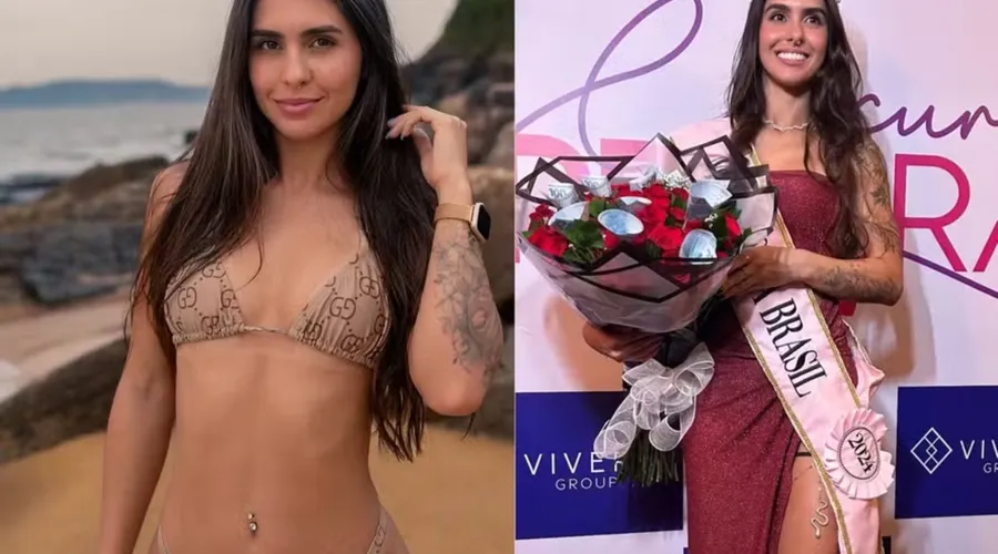 Carioca vence disputa pelo título de vagina mais bonita do Brasil