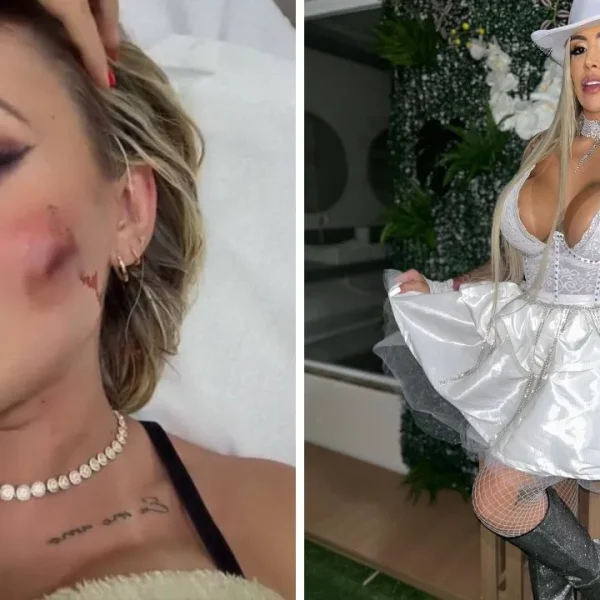 Andressa Urach tem rosto cortado em briga com Juju Ferrari; vídeo