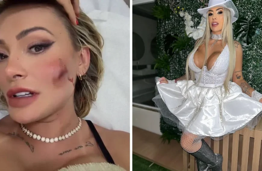 Andressa Urach tem rosto cortado em briga com Juju Ferrari; vídeo