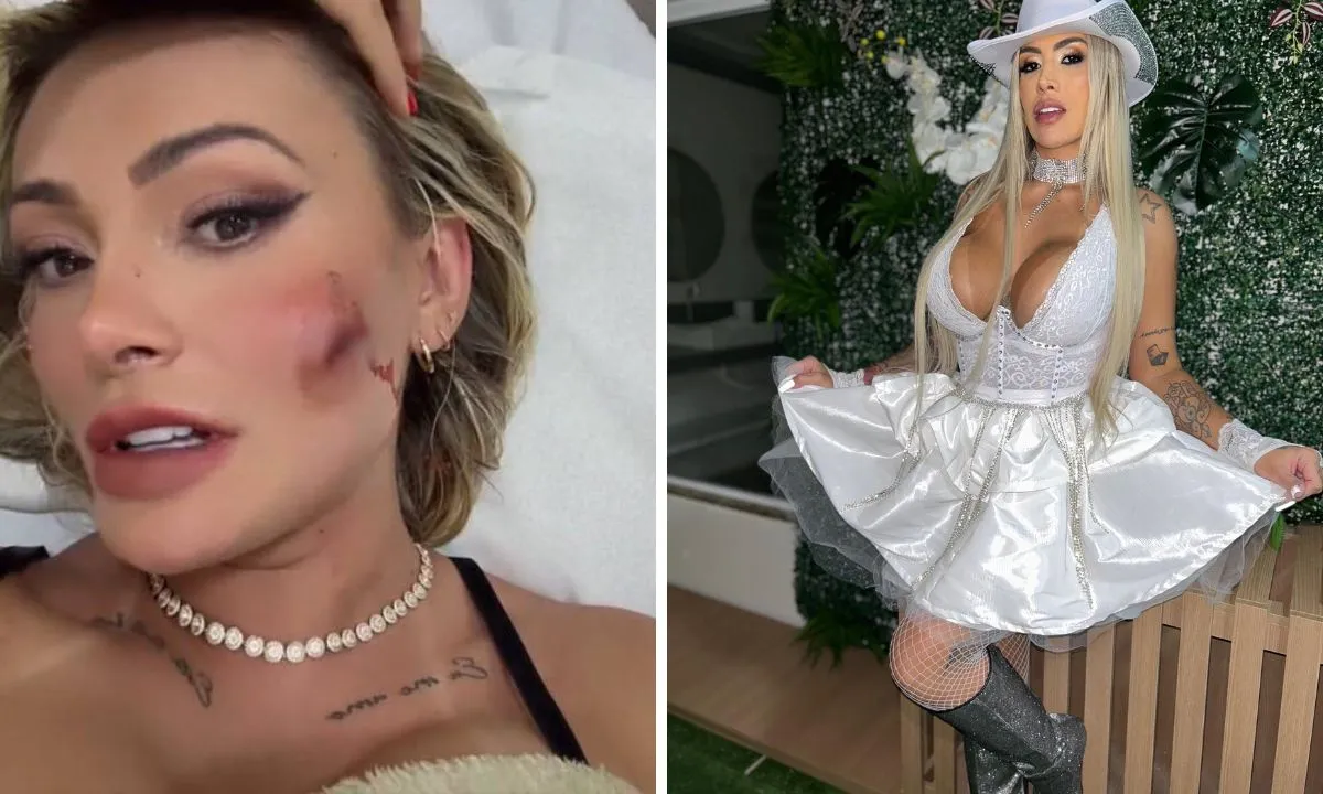 Andressa Urach tem rosto cortado em briga com Juju Ferrari; vídeo