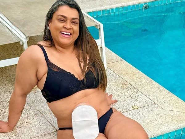 Preta Gil é submetida a nova cirurgia e tranquiliza seguidores