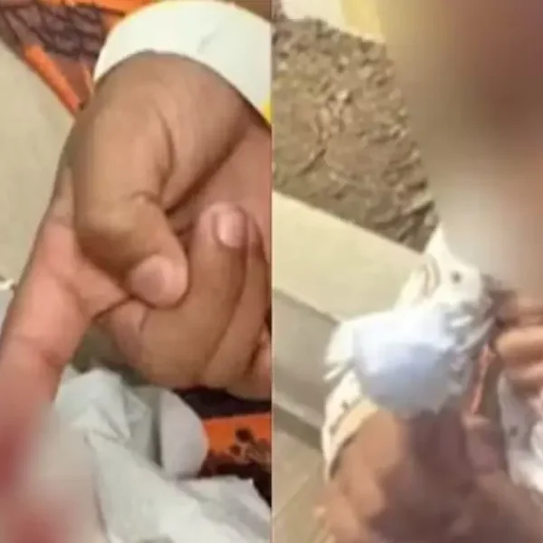 Menino é atacado por piranhas em lago no Sudoeste baiano