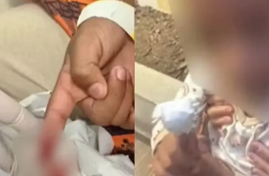 Menino é atacado por piranhas em lago no Sudoeste baiano