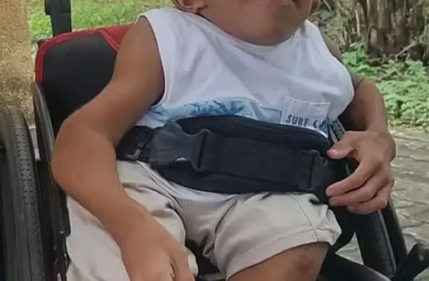 Morre menino que sofria com ‘ossos de vidro’ em Feira de Santana