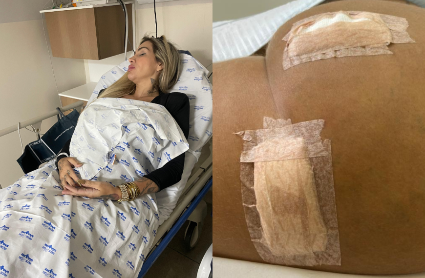 Influenciadora é internada às pressas devido infecção causada por hidrogel no bumbum