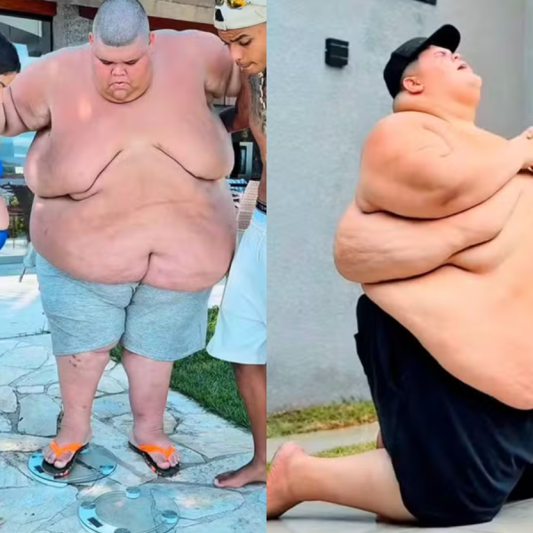 Influenciador Gordão da XJ perde mais de 115 kg e bate meta de peso para fazer bariatrica