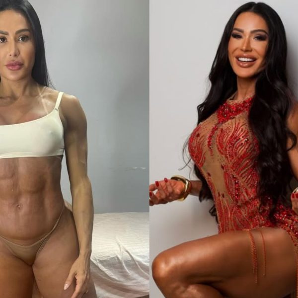 Gracyanne mostra antes e depois e explica ganho de 20 kg na balança após cirurgia