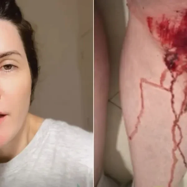 Apresentadora da Record reage a assalto e fica ferida na Ondina, em Salvador