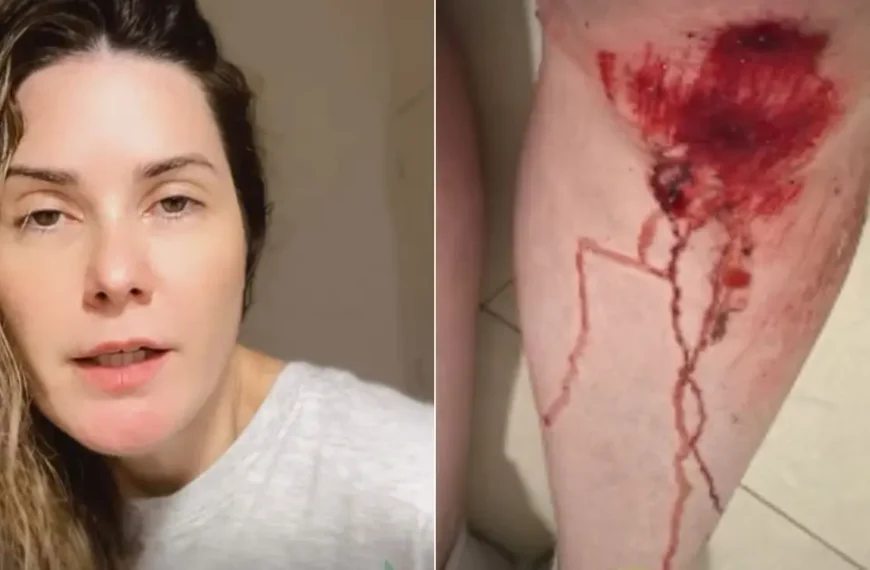 Apresentadora da Record reage a assalto e fica ferida na Ondina, em Salvador