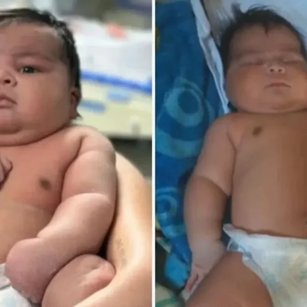 Bebê com 6,5kg nasce de parto normal, tem ombro lesionado e mãe leva 55 pontos no ES