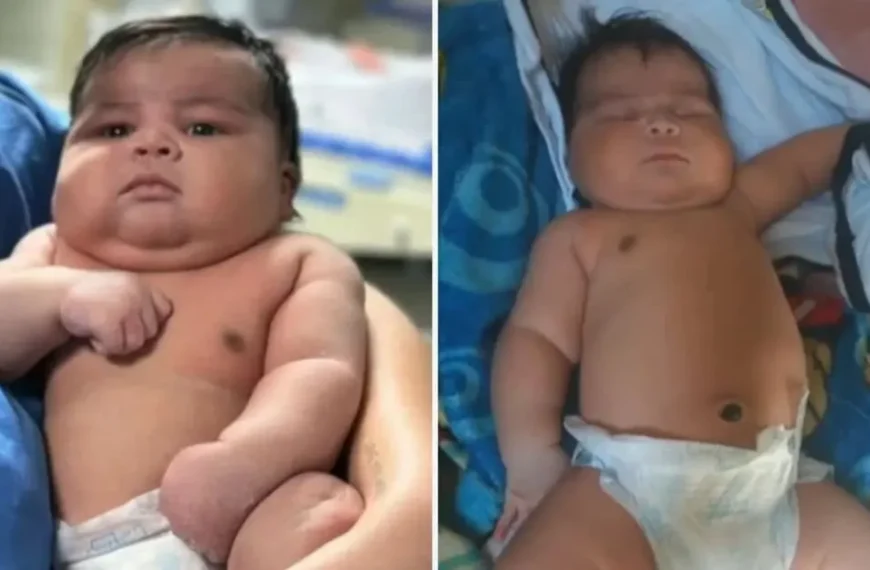 Bebê com 6,5kg nasce de parto normal, tem ombro lesionado e mãe leva 55 pontos no ES