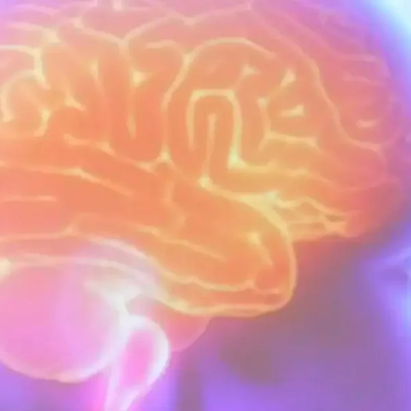 AVC silencioso é 10 vezes mais comum do que os sintomáticos e pode causar demência progressiva