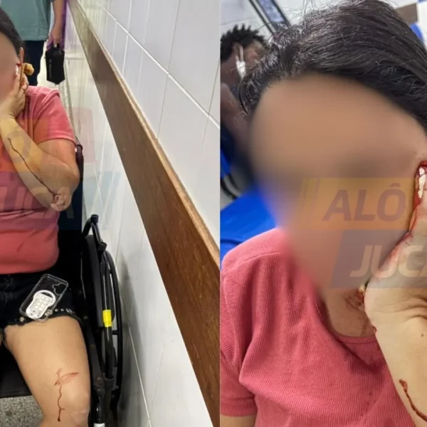 ABSURDO: senhora é atacada com garrafa de vidro por mulher em situação de rua enquanto fazia exercícios na Graça