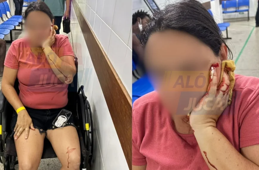 ABSURDO: senhora é atacada com garrafa de vidro por mulher em situação de rua enquanto fazia exercícios na Graça