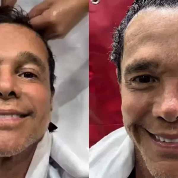 Netinho celebra retorno de crescimento capilar após tratamento contra câncer: “Deus é muito bom”