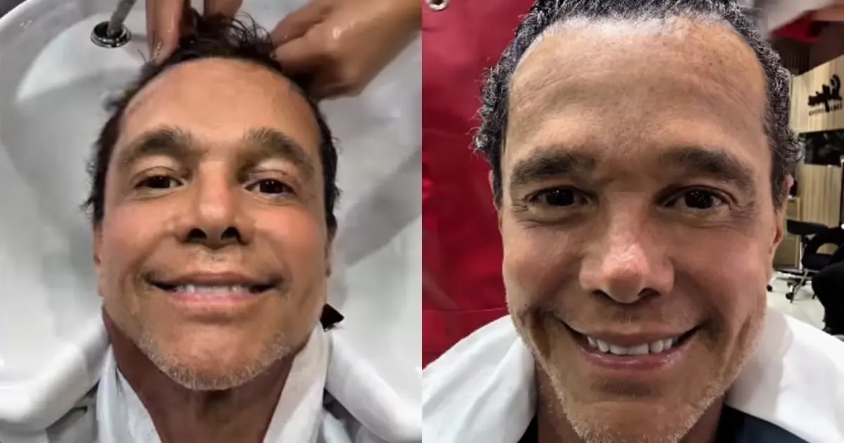 Netinho celebra retorno de crescimento capilar após tratamento contra câncer: “Deus é muito bom”