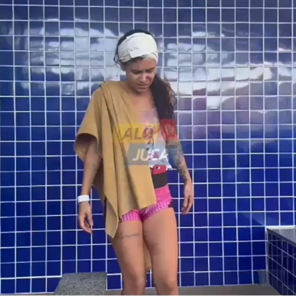 TENTATIVA DE FEMINICÍDIO: mulher pede para companheiro não gritar a filha e recebe uma facãozada